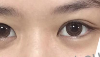 新娘子常問之contact-lens 篇