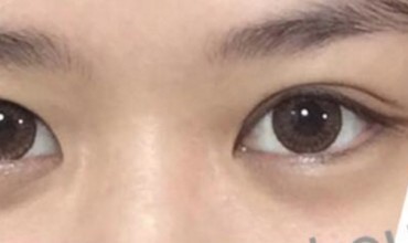 新娘子常問之contact-lens 篇