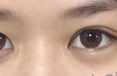 新娘子常問之contact-lens 篇